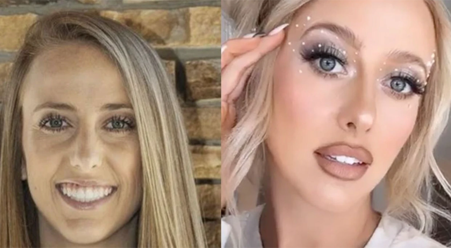 Has Brittany Mahomes Had Plastic Surgery? Rumors and Facts About