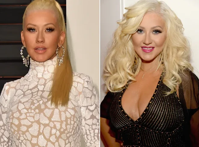Christina Aguileras Plastic Surgery 2